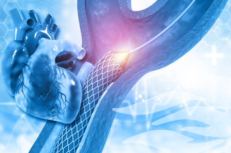 Target Aortic Stenosis