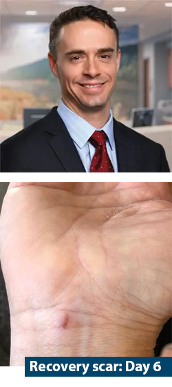 Dr Cotton and Sonex recovery scar